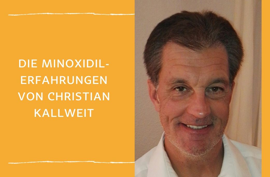 Tschüß, Geheimratsecken und Co. – die Minoxidil-Erfahrungen von Christian Kallweit